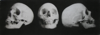 Skull 2 x 6.5"